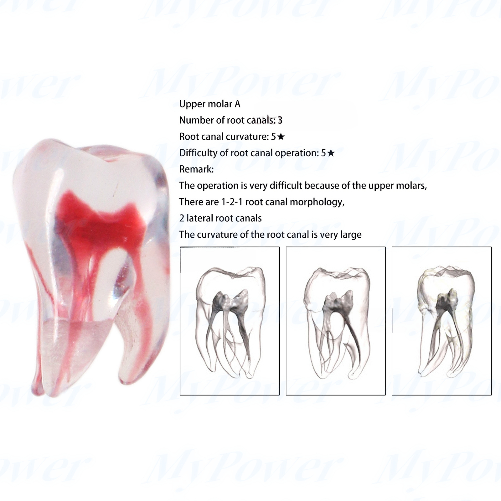 Dental Training 3D RCT Endo Tooth Model Practice Model Curved Root Resin Teeth