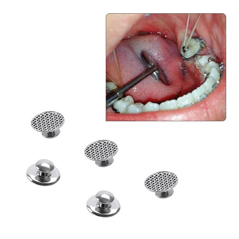 10 Pcs/Pack Dental Orthodontic Round Lingual Button Bondable Mesh Base Split