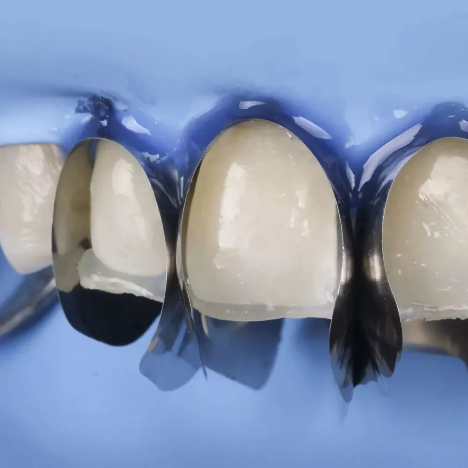 Polydentia Unica Anterior Dental Matrix System Intro Kit II Free Ship