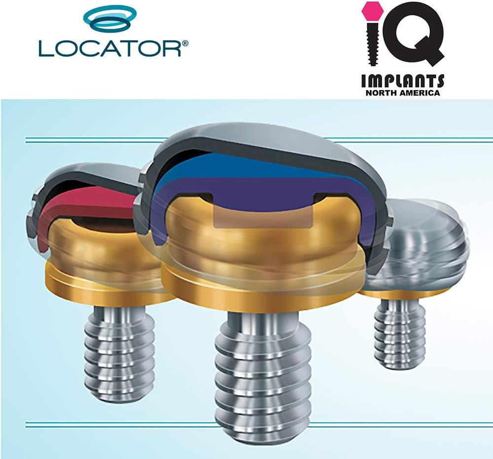 Locator Genuine Original Replacement Male Retention Inserts Caps, Standard, Ligh