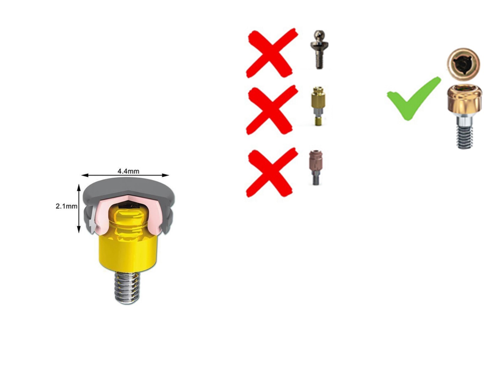 US Implant Replace Standard Male Inserts Fit ZEST Locator Legacy Dental Abutment