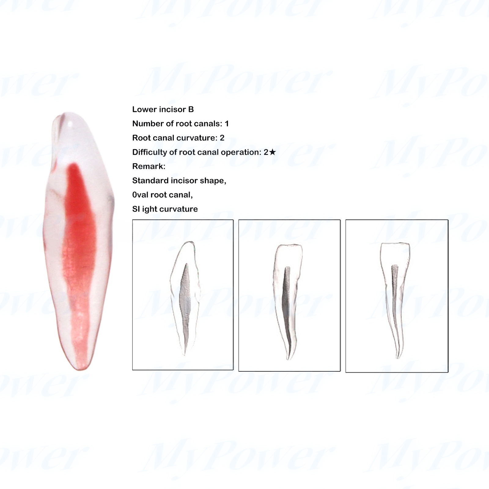 Dental Training 3D RCT Endo Tooth Model Practice Model Curved Root Resin Teeth