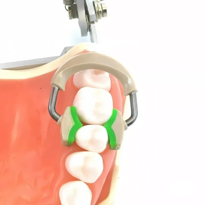 Dental Fit Garrison Palodent System Matrix Bands Ring Sectional Matrice Clamp