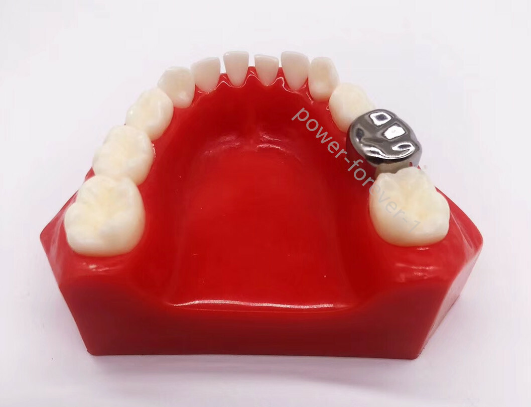 5pcs/box Dental Kids Crown Protect Teeth Primary Molar Stainless Steel Pediatric