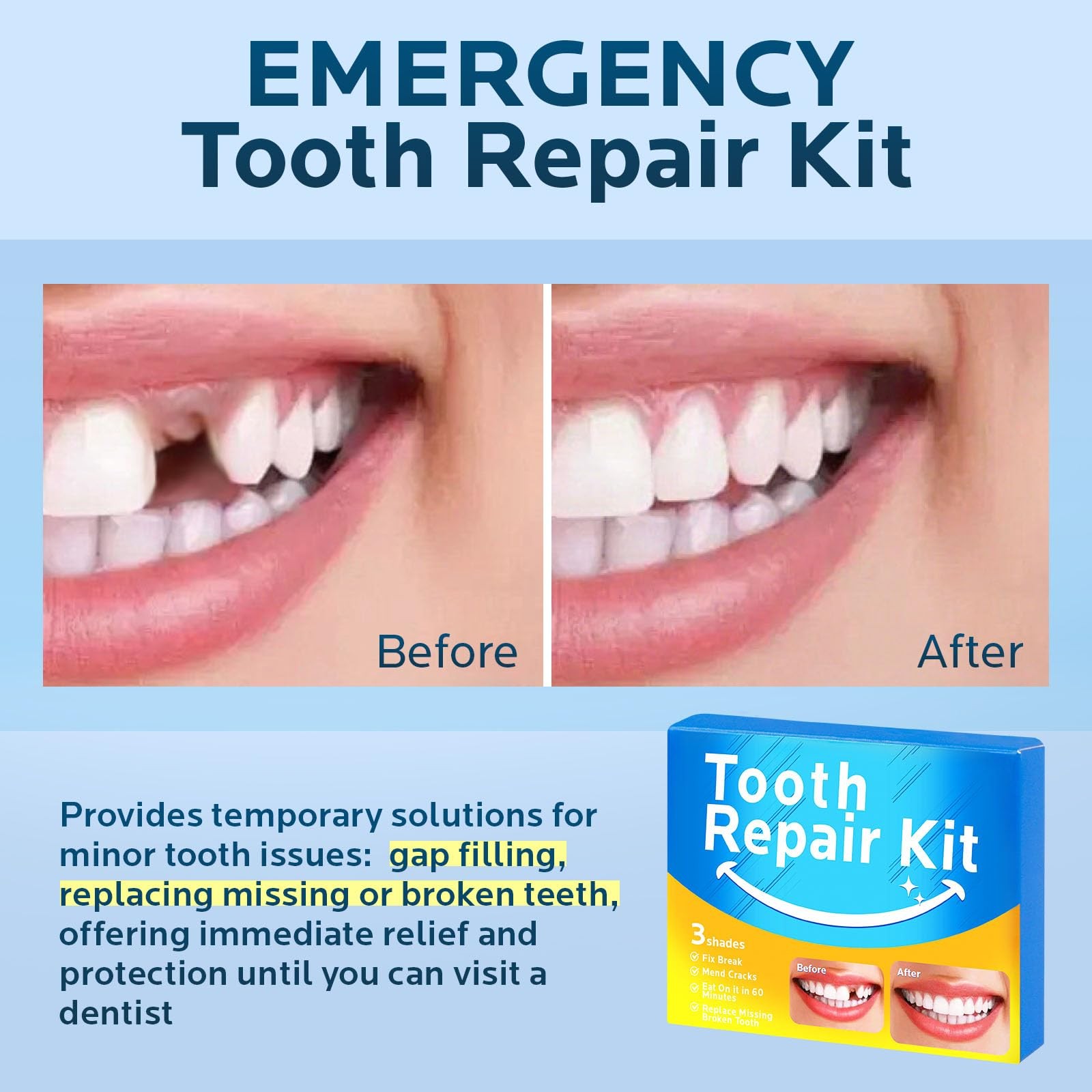 Temporary Tooth Repair Kit Moldable Thermal Beads 3 Shades 10 Sizes Filling Gap