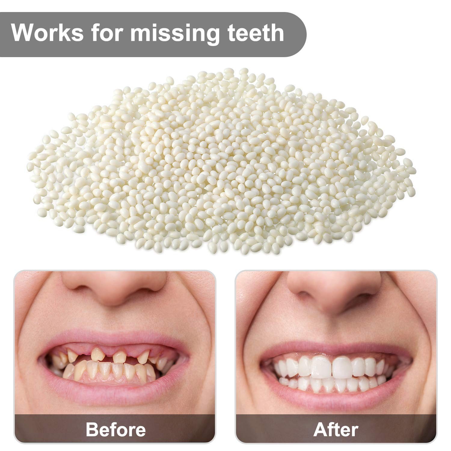 Nuanchu 100g Tooth Repair Kit Moldable Beads 3.52 Ounce (Pack of 1), White