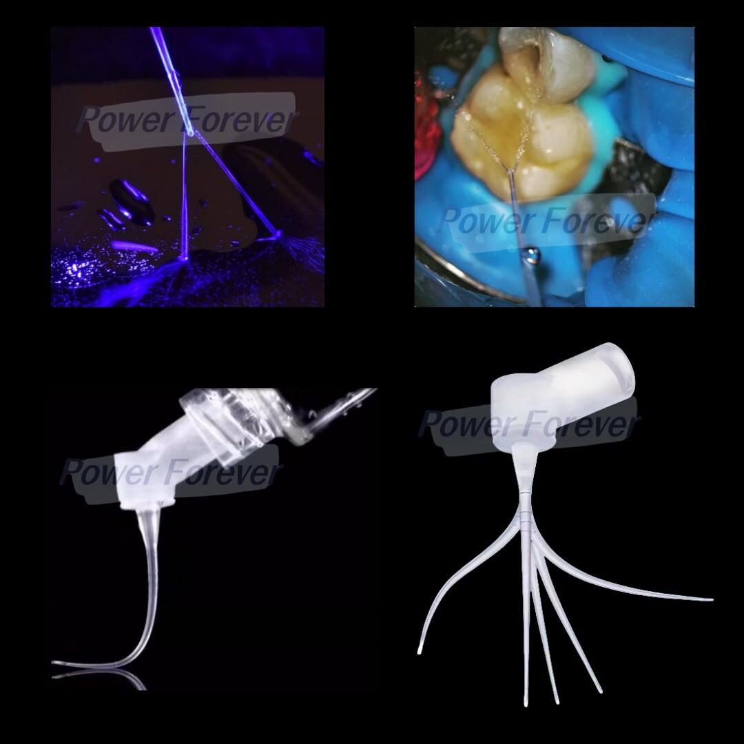 Dental PD Tips Endodontics Root Canal Therapy IrriFlex Style Flexible Irrigator