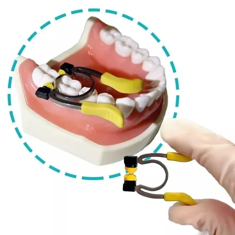2 Type Dental Matrix System Clamp Ring R8 Niti Nickel Titanium Alloy for Kids