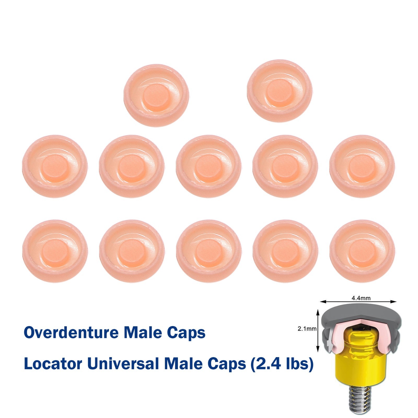 Dental Locator Classic Pink Standard Male Insert 2.4 lbs Light Retention Cap Set