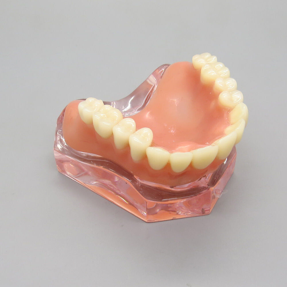 Dental High Quality Model of Upper Teeth Dentures Superior 4 Implants Maxillary