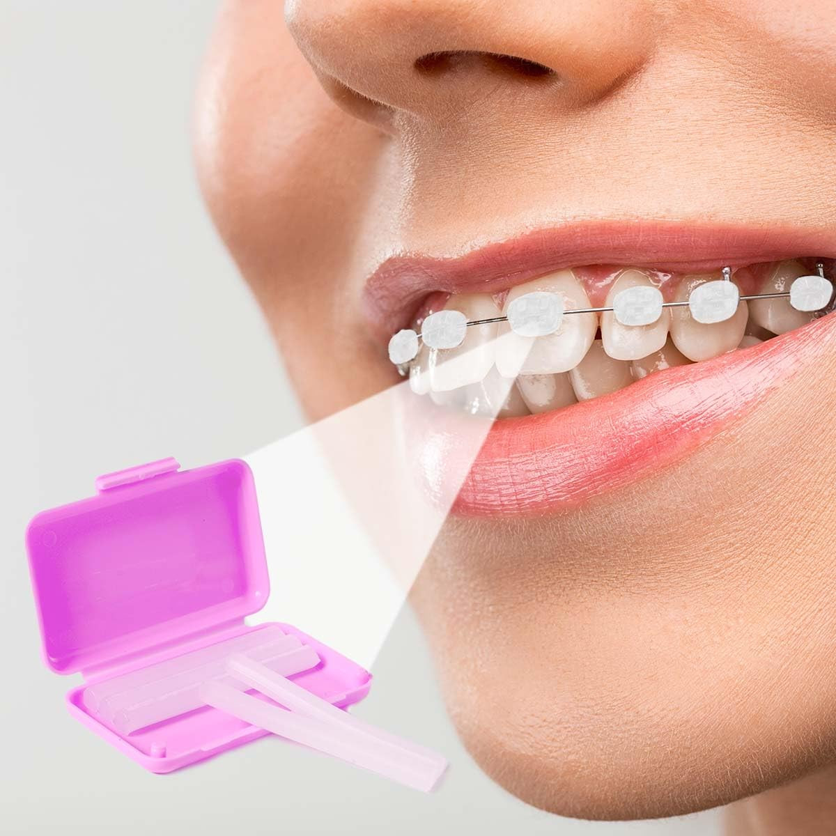 20Pack/100pcs Dental Orthodontics Ortho Wax Braces Gum Irritation 10 Fruit Scent
