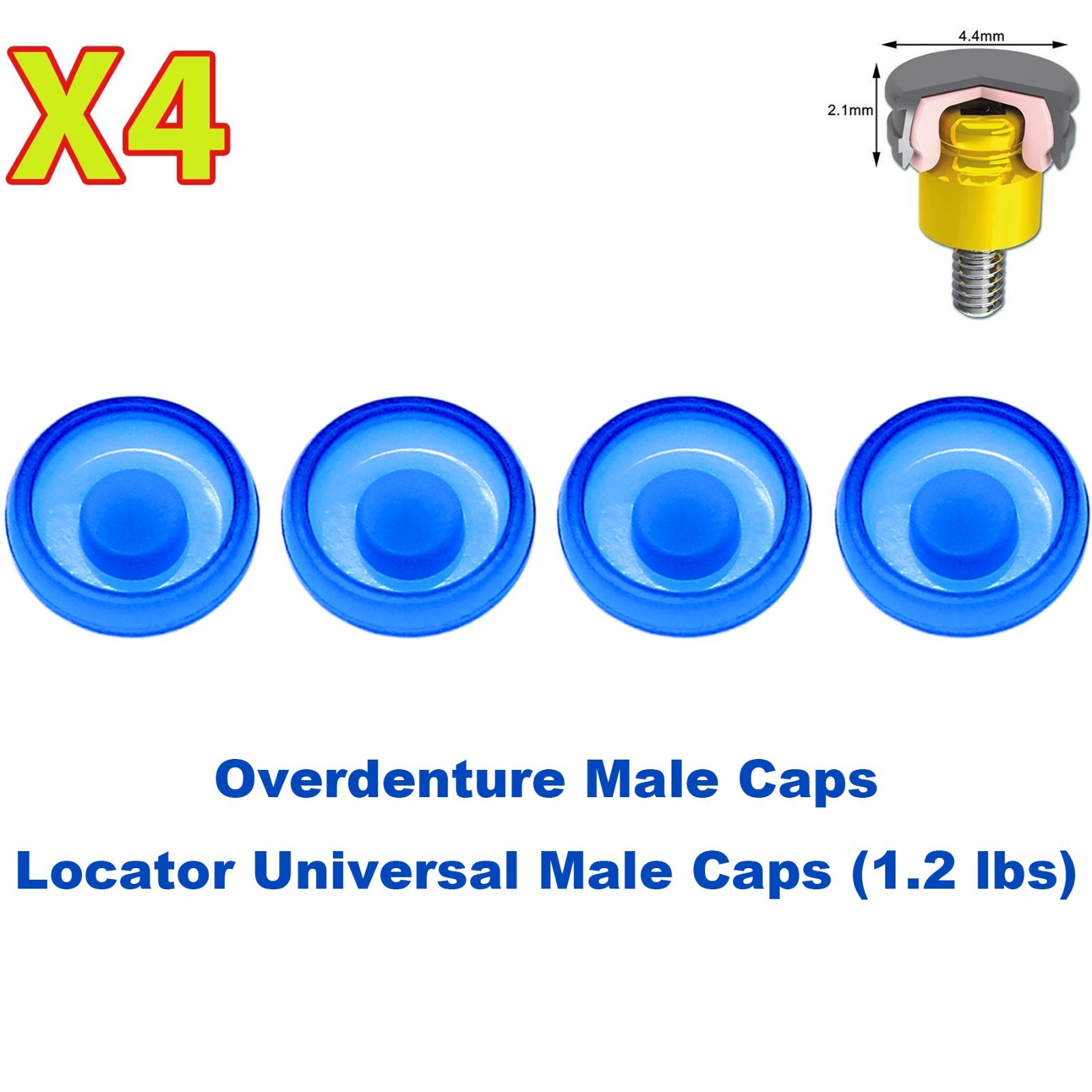 US 4Pcs Dental Implant Overdenture Retention Caps For Locator Abutment Insertion