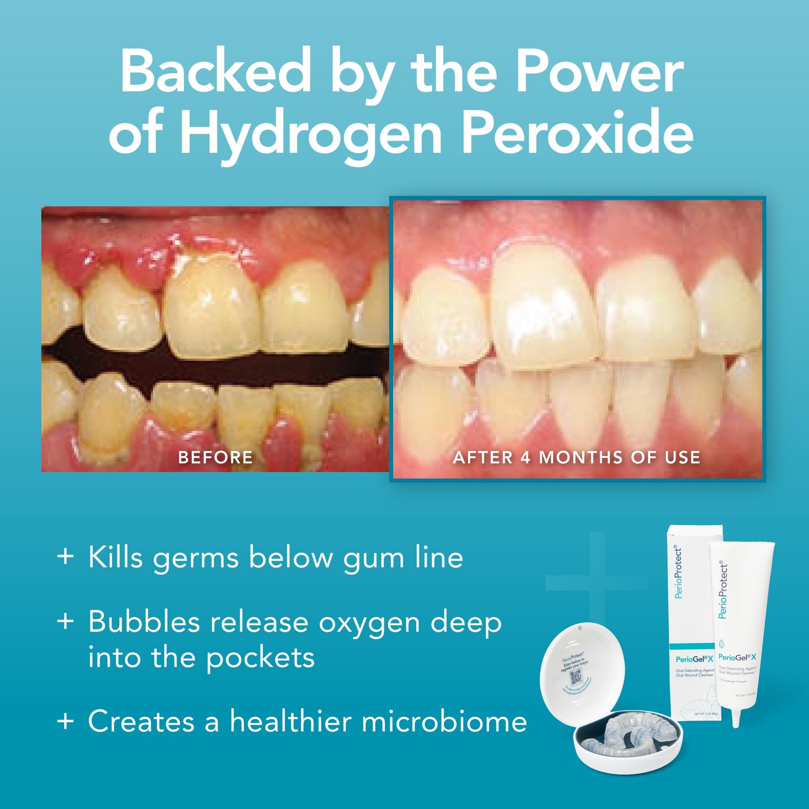 Periodontal Treatment for Teeth Promotes Healthy Gums Care Gel 3 fl oz New