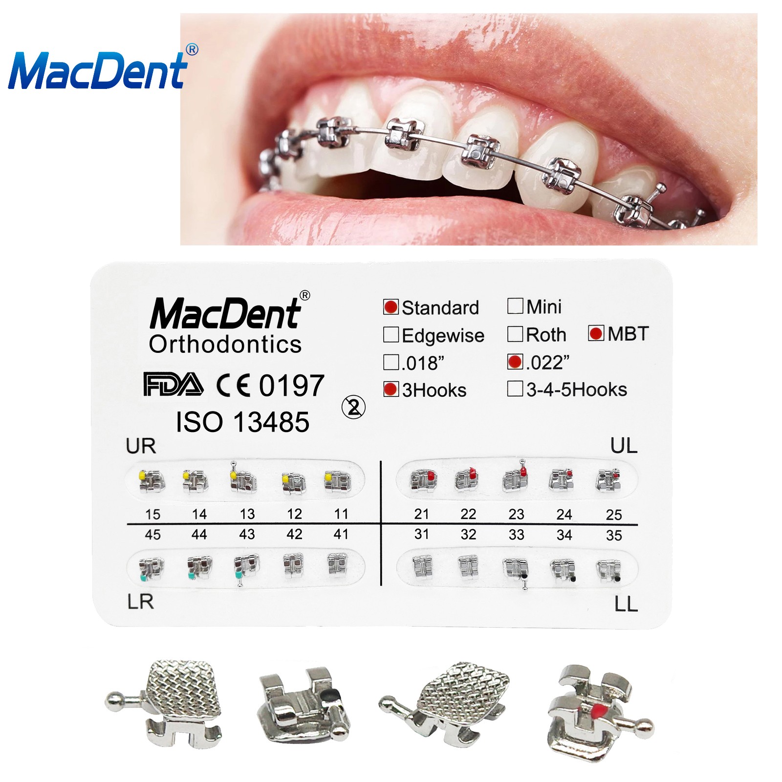 Dental Brackets /Orthodontic Light Cure Adhesive Kit/Blue Green Glue/Mini No-Mix