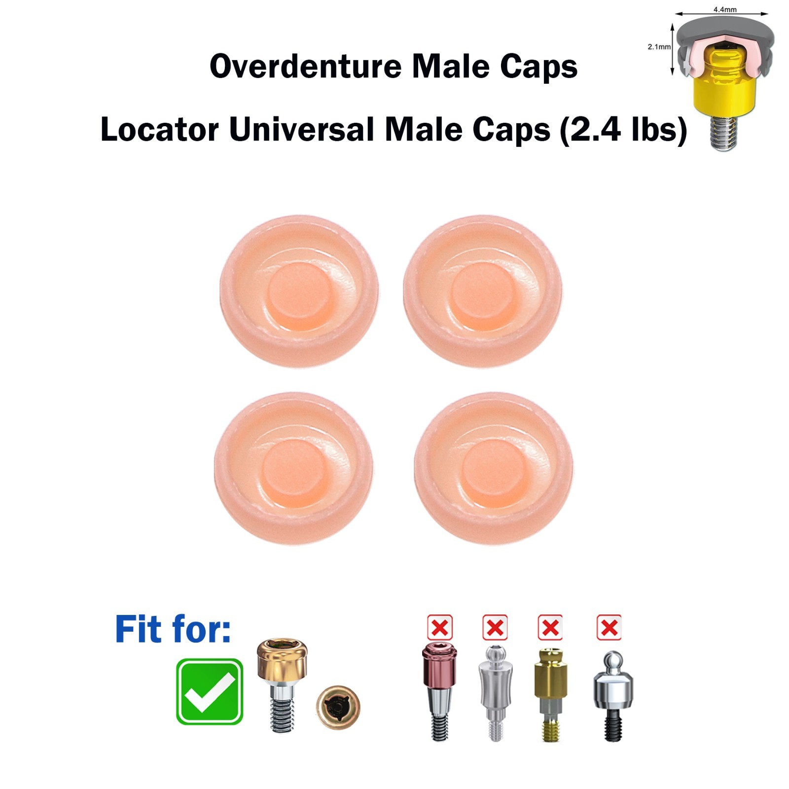 US ZEST Locator Replacement Retention Male Caps Inserts For Dental Overdenture