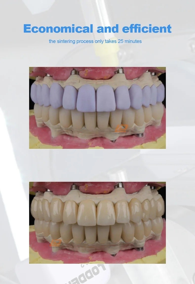 C14 Emax Lithium Disilicate Block Chairside CAD/CAM CEREC Same-Day Crown Veneer