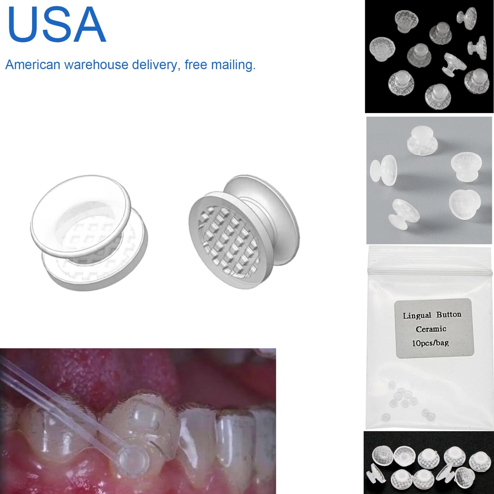 100Pcs Composite Dental Orthodontic Ceramic Clear Lingual Button Bondable Round