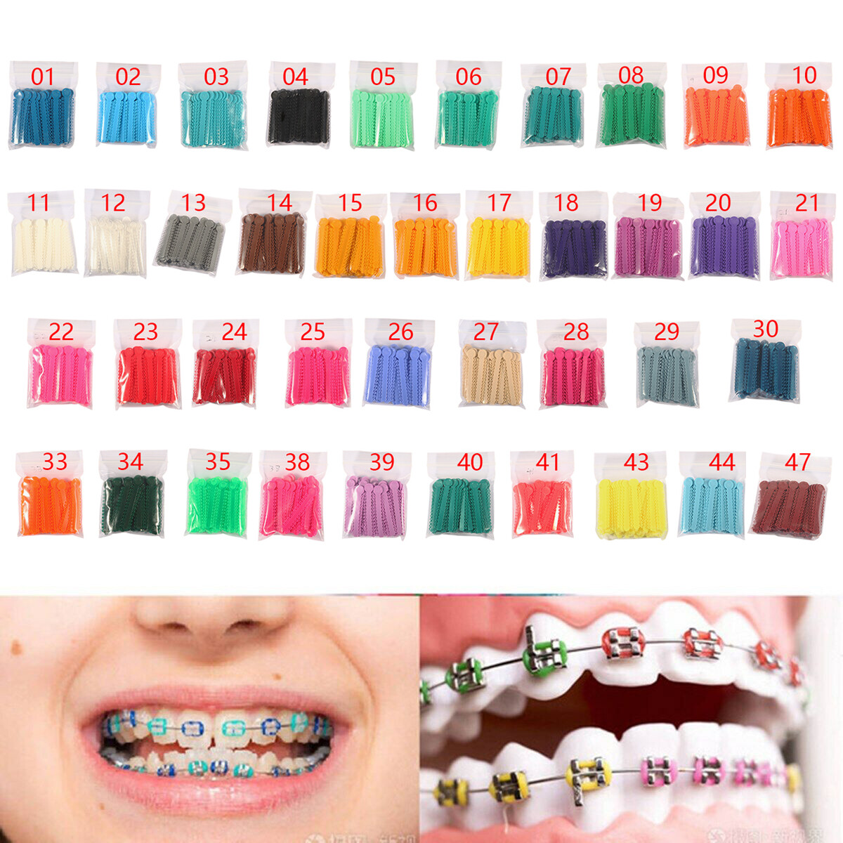 1040 Pcs Dental Ortodoncia Elástico Ligaduras Bandas de Goma para Brackets