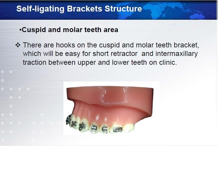 5 Orthodontic Self Ligating Metal Brackets Roth/Mbt /Edgewise .018”/.022 (FDA)