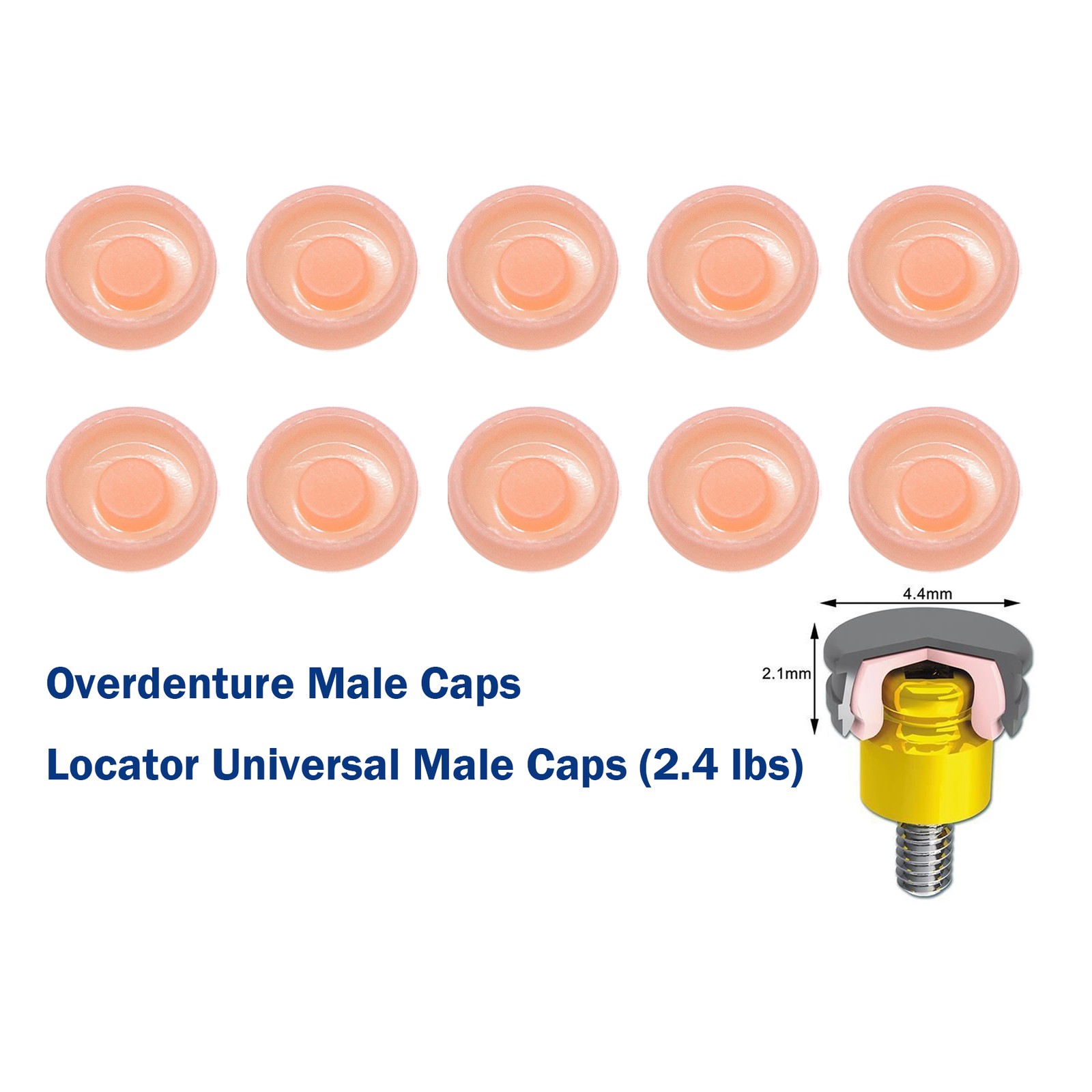 US Dental Locator Overdenture Abutment & Caps Fits Nobel/Hiossen/Zimmer/MIS/TSV