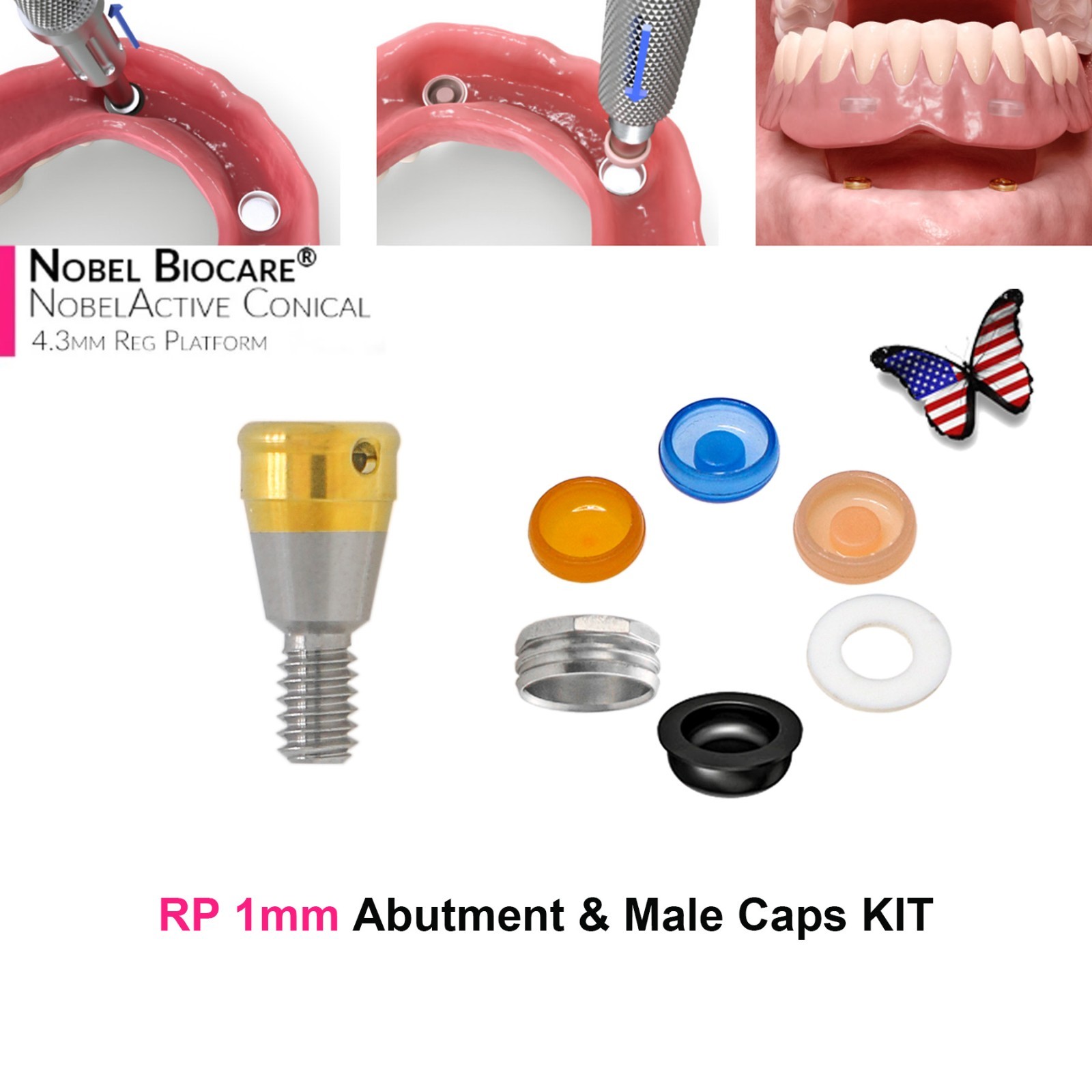 ZEST NOBEL Locator Abutment for Nobel Biocare Active Conical Connection NP & RP
