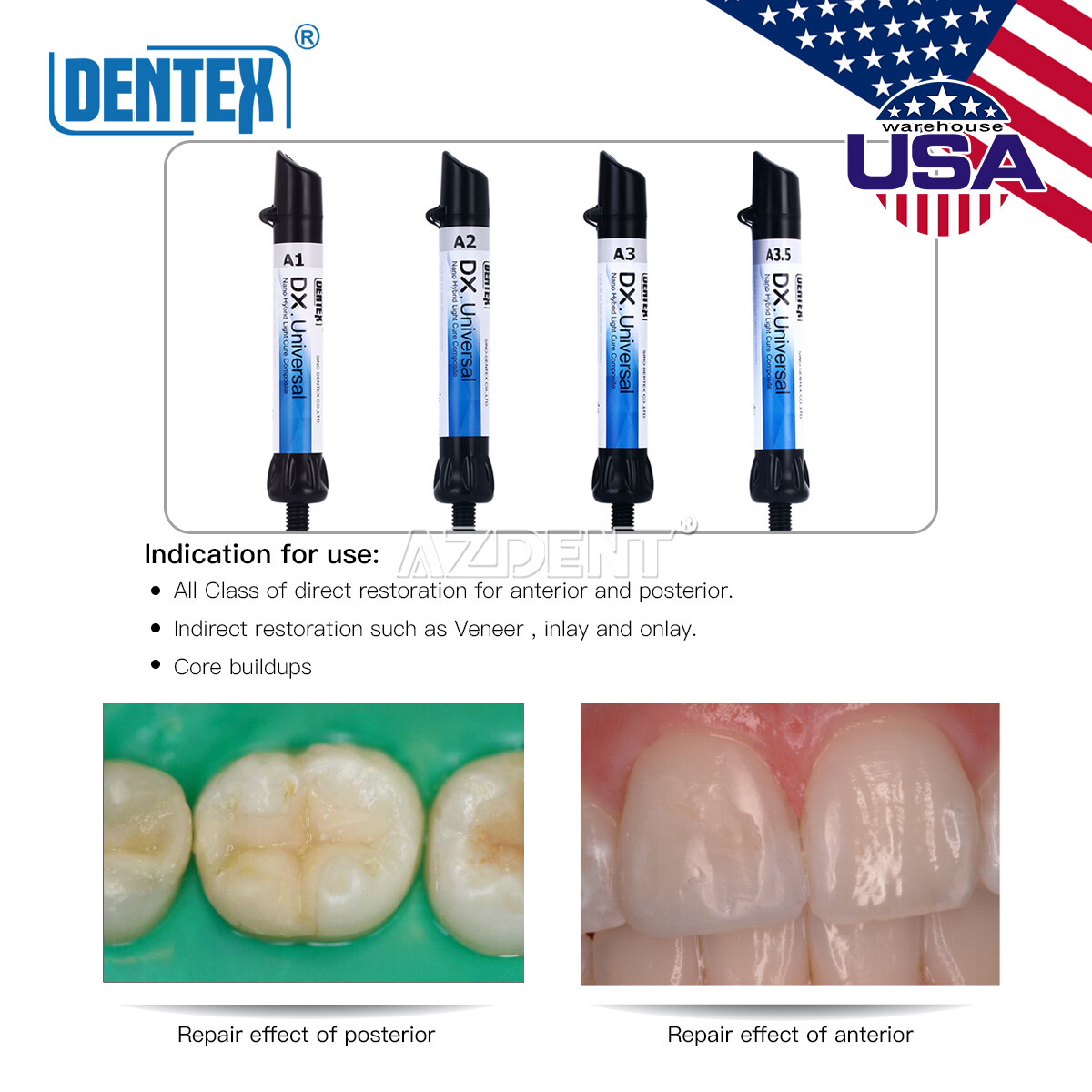 Dental Cure Light Composite Resin A1 A3 / Temporary Filling Material Blue