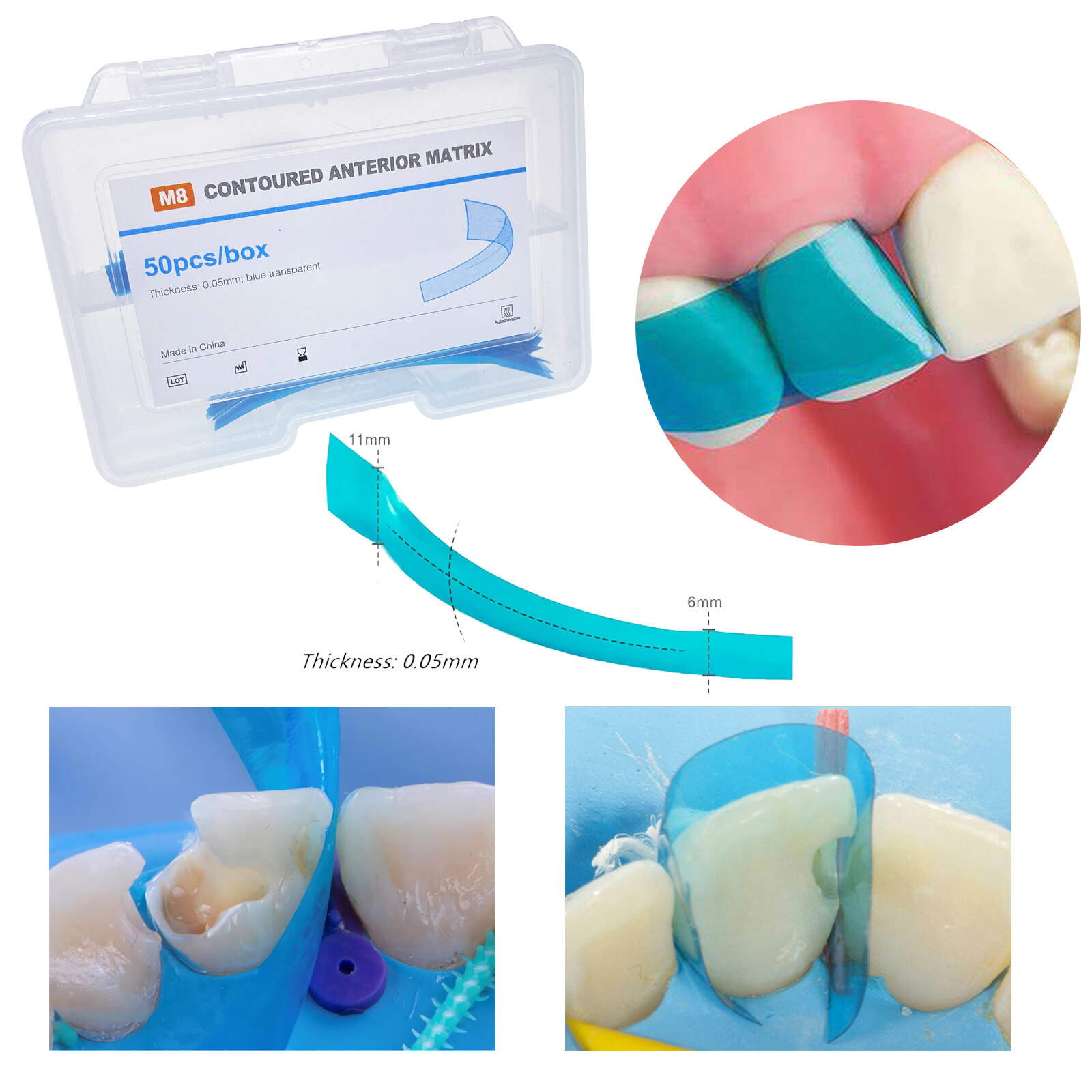 Dental Contoured Anterior Matrix Bands Polyester Anterior Strips Matrices System