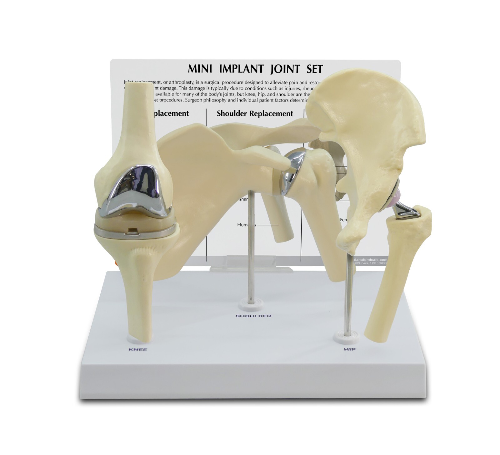 Implant Mini-Implant Joint Set of 3 GPI LFA #1910. Make Us an Offer! SEE VIDEO