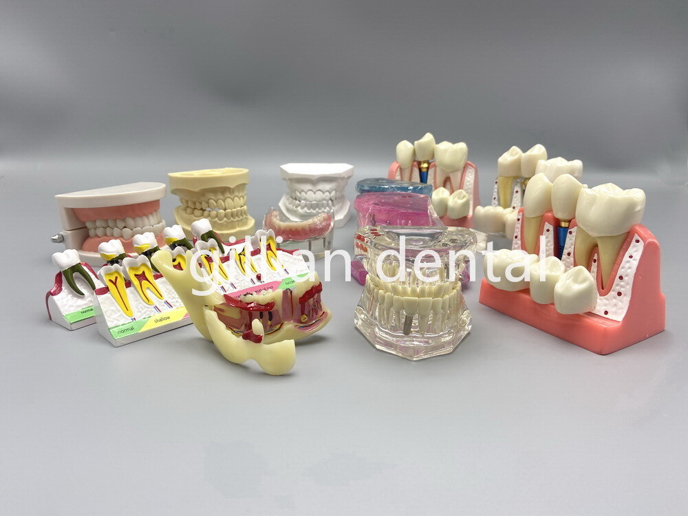 Dental Model Teeth Implant Restoration Bridge Teaching Study Medical Science