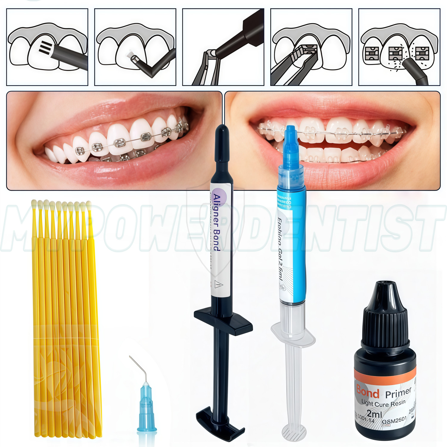 Dental Light Cure Orthodontic Adhesive Paste for Aligner Attachments 2.5g Kit