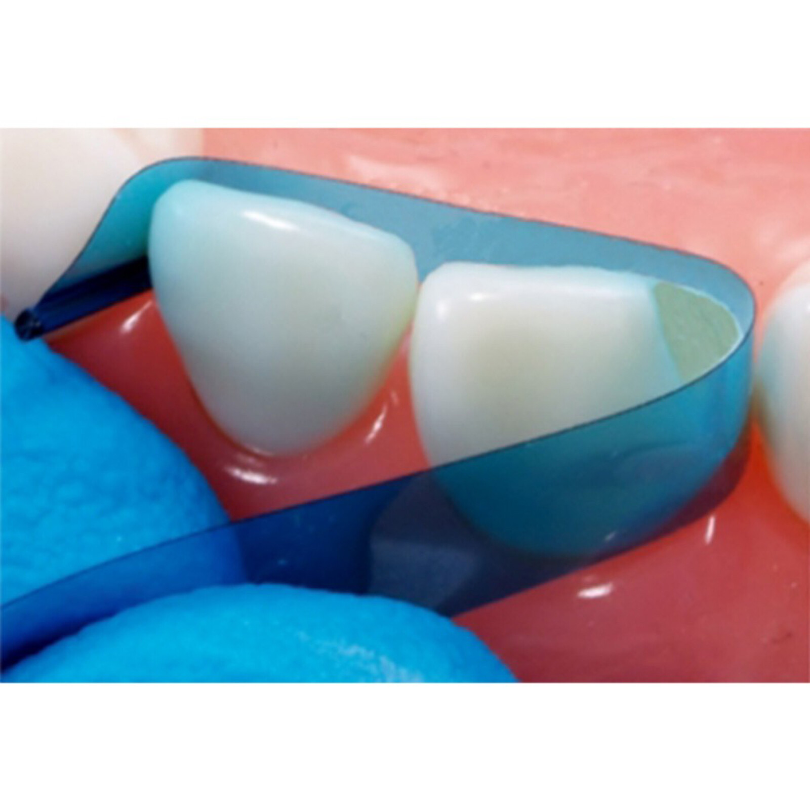 Dental Blue Tint View Matrix Contoured Anterior Matrices Mylar Anatomical Strip