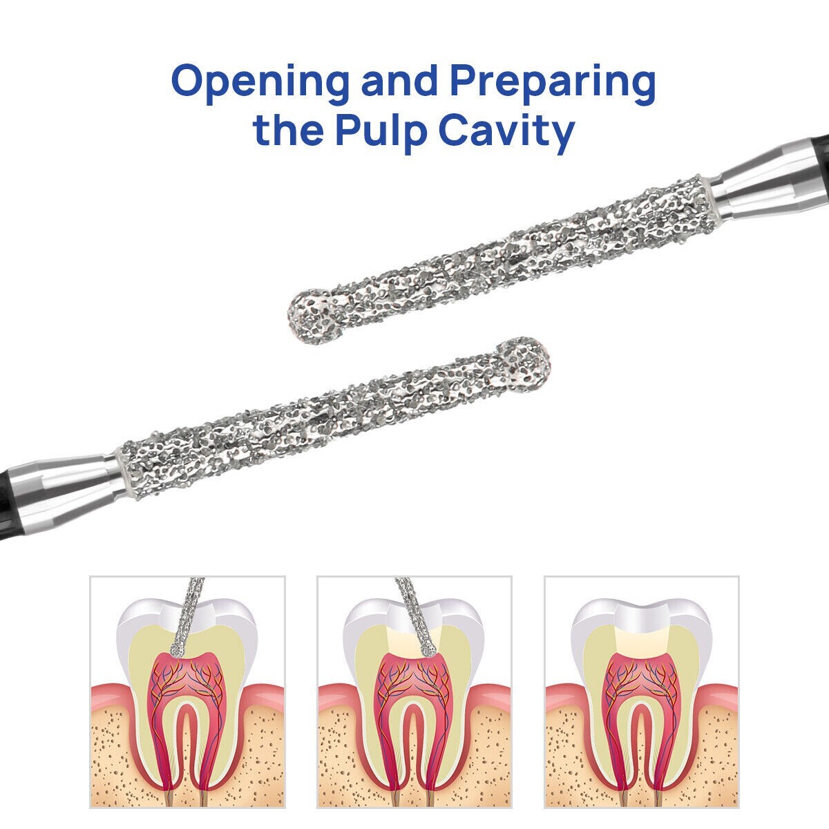 1-200Pack Dental Endo Diamond Burs 1.6mm For Opening preparing Endo Access Bur