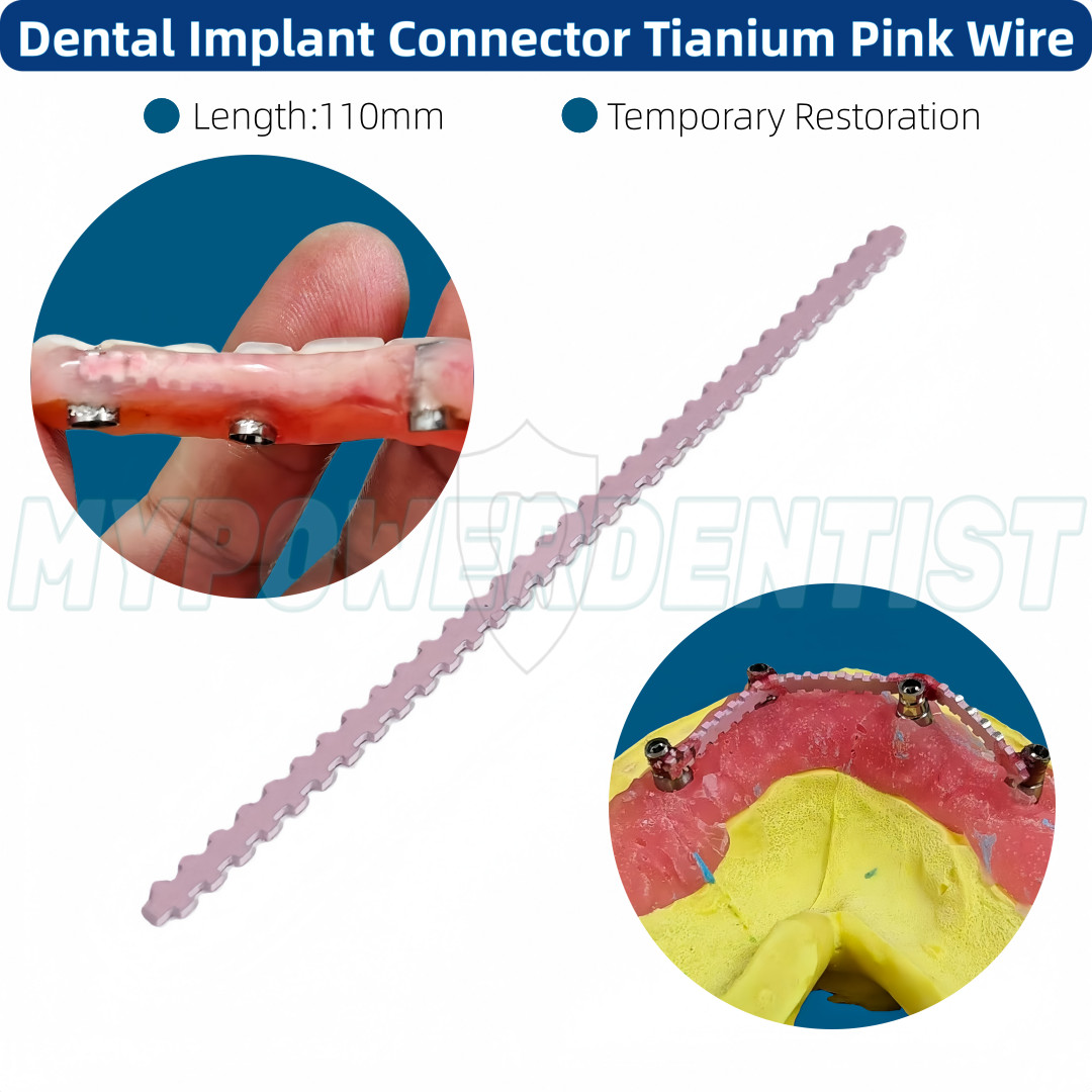 Dental Titanium Wire Denture Temporary Restoration Transfer Rod Fixed Pink 110mm
