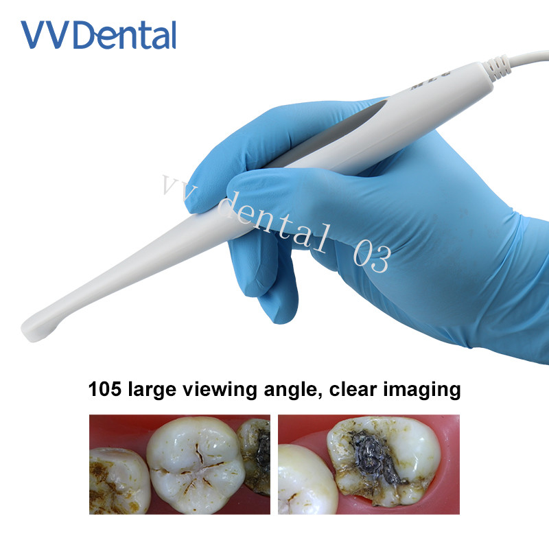Dental Oral Intraoral Camera USB 13MP High Resolution 6mm Super Mini Lens