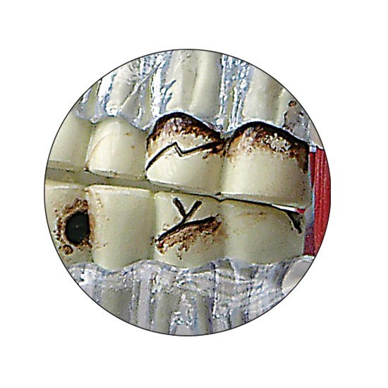 TMJ Temporomandibular Jaw GPI Model LFA #2880. Make Us an Offer! SEE VIDEO