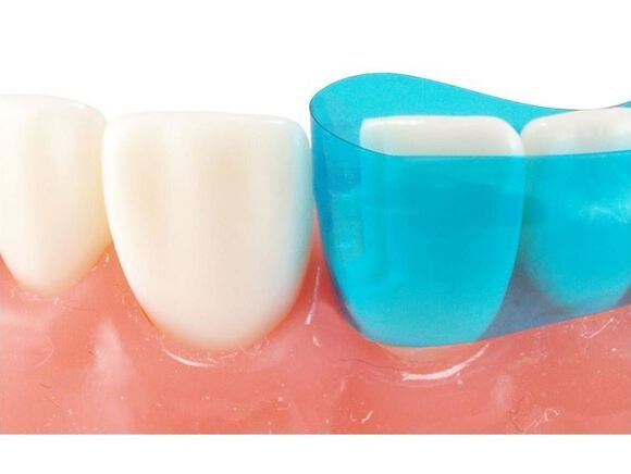 Dental Contoured Anterior Matrix Bands Polyester Anterior Strips Matrices System