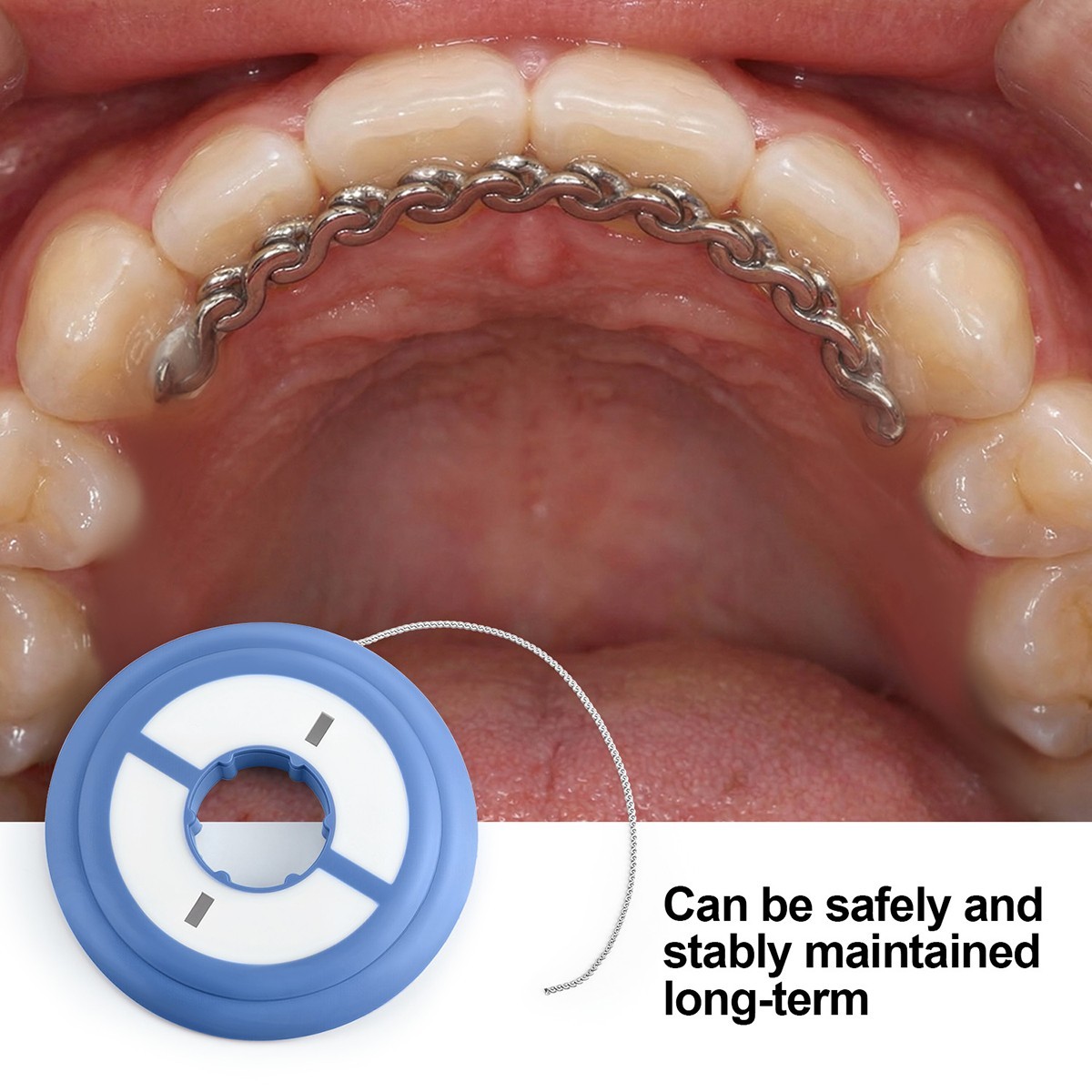 Dental Orthodontic Round Rectangular monoblock Bondable Metal Lingual Button