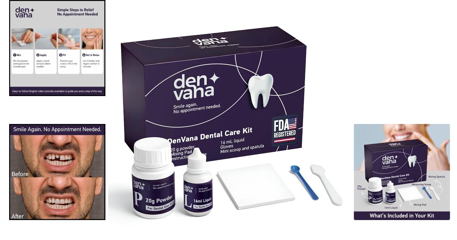 Dental Cement Kit – Zinc Oxide Eugenol Temporary Filling & Crown Repair | Too…