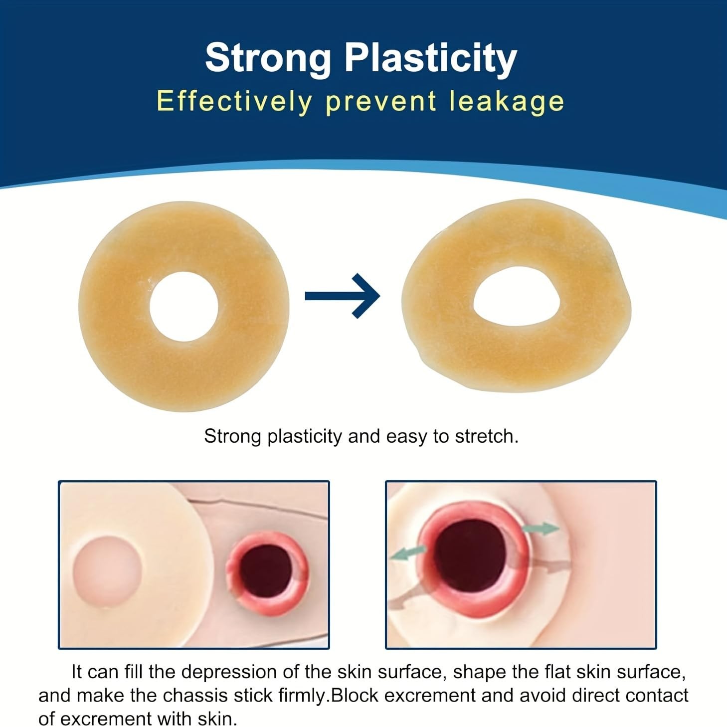 10 PCS Ostomy Barrier Rings, 2mm 10 Count (Pack of 1), 2mm,10pcs/Box