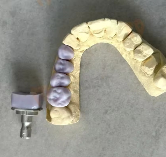 C14 Dental Emax CAD/CAM CEREC Ceramic Blocks Lithium Disilicate Block – 5pcs/Box