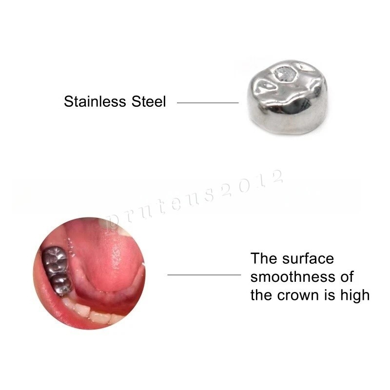 Dental Material Children’s Stainless Steel Baby Teeth Prefabricated Crown 48/Box