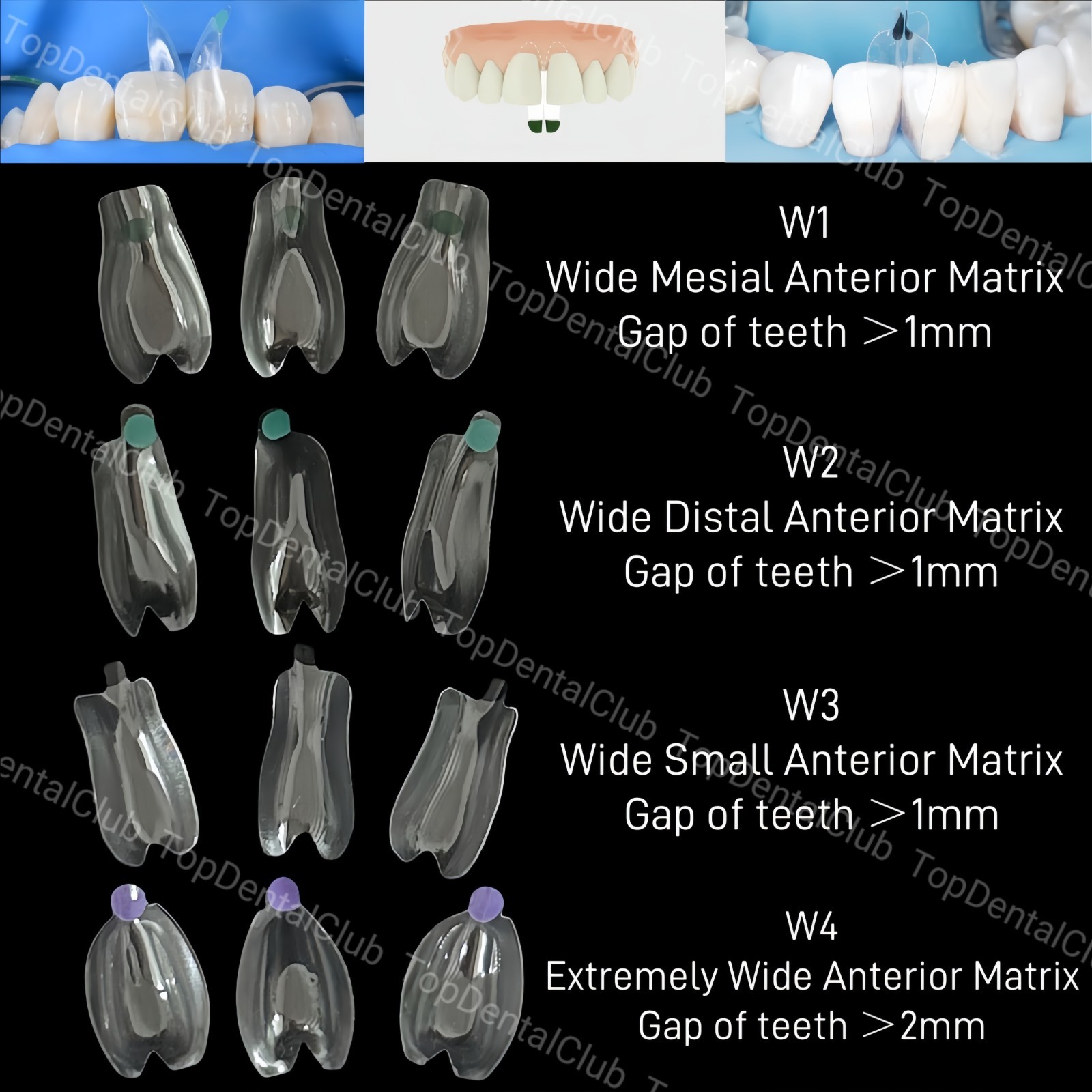 Clear Matrix Dental Anterior Posterior Transparent BT Matrices Fit BioClear