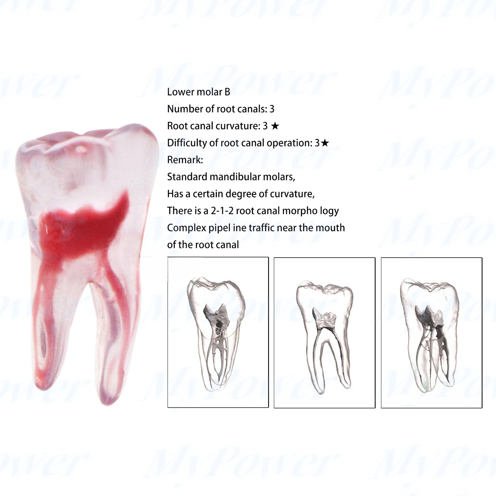 Dental Training 3D RCT Endo Tooth Model Practice Model Curved Root Resin Teeth