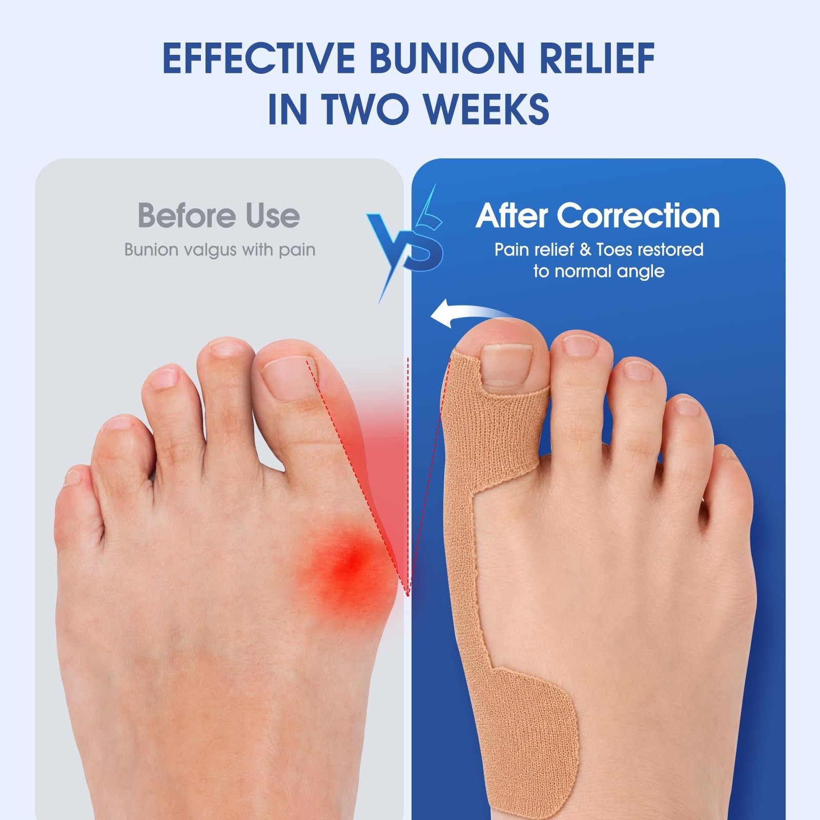 Bunion Corrector Kinesiology Tape for Women & Men, Precut One Size, Skin Tone