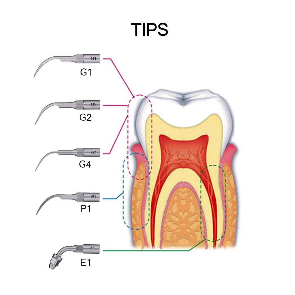 30x Dental Anterior Matrix Bands Proximal Anterior Strips Twin Anterior Matrices