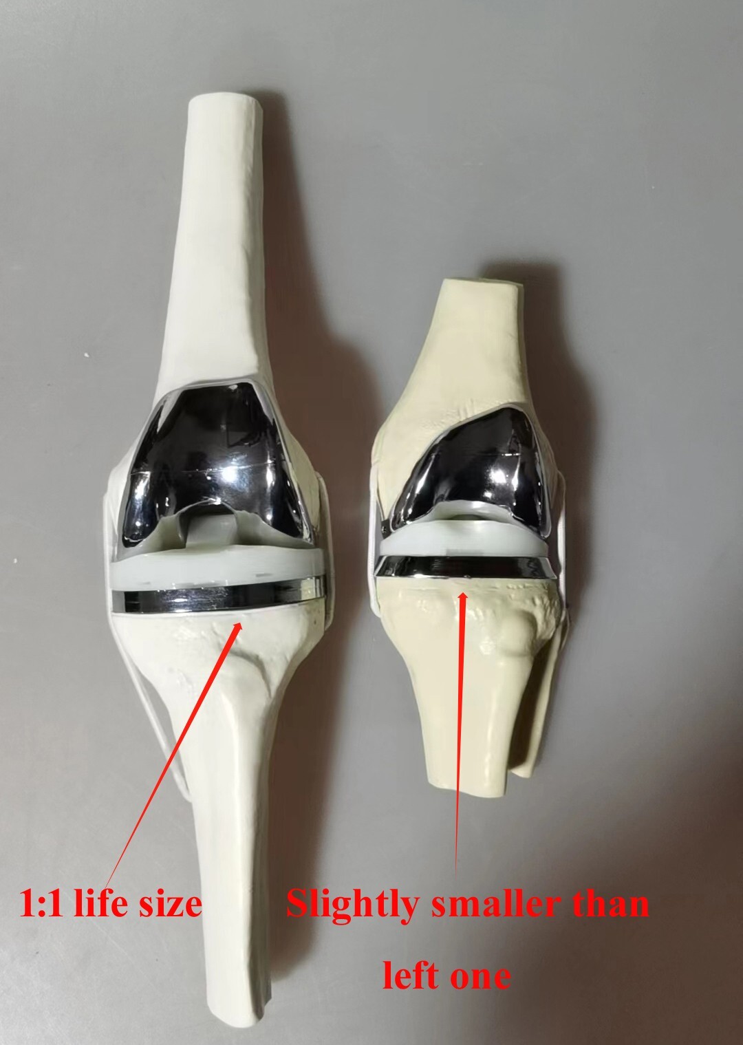 Detachable Artificial Knee Prosthesis Medical Anatomical Teaching Demo Display