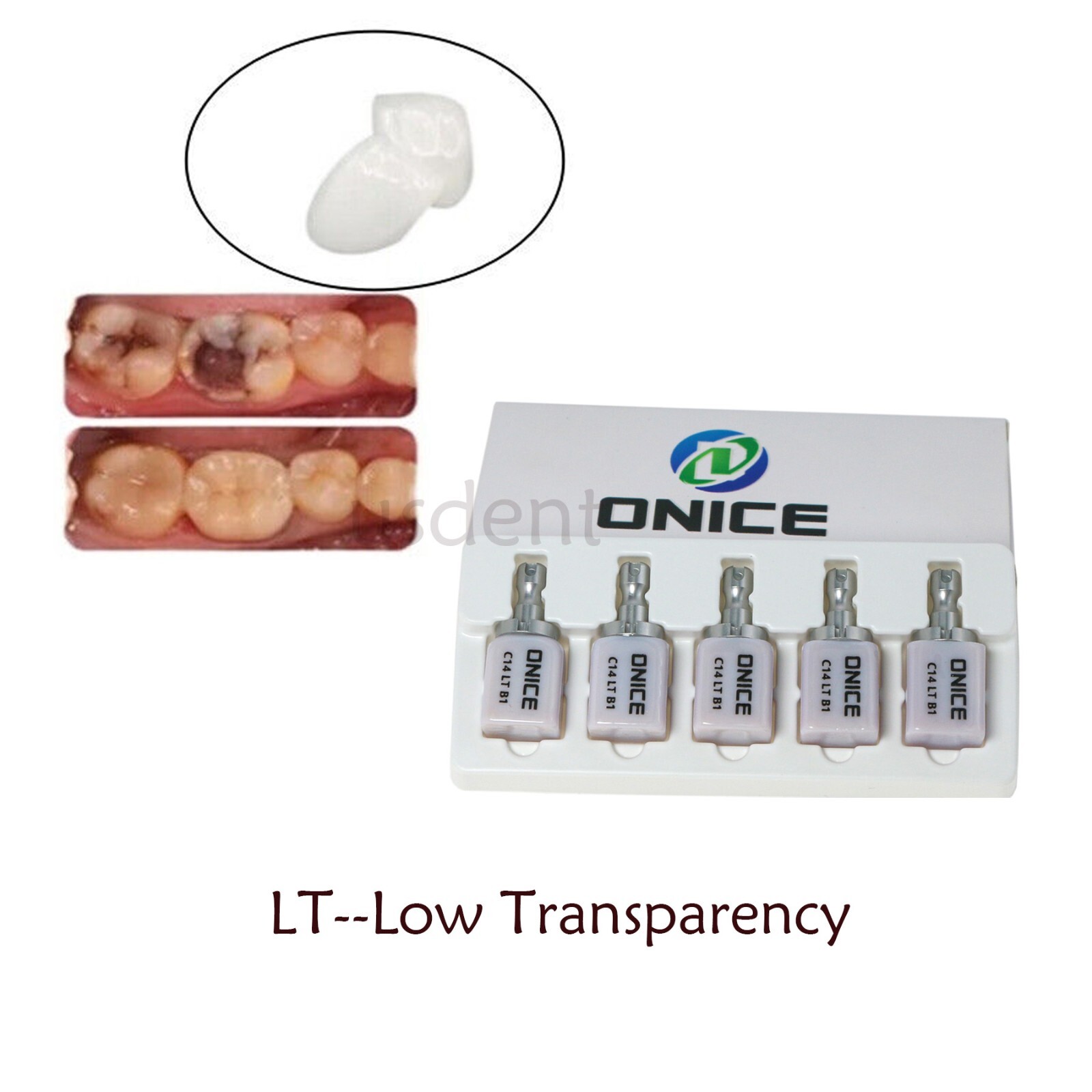 C14 LT Dental Ceramic Lithium Dislicate Blocks For Sirona Cerec E-max CAD CAM