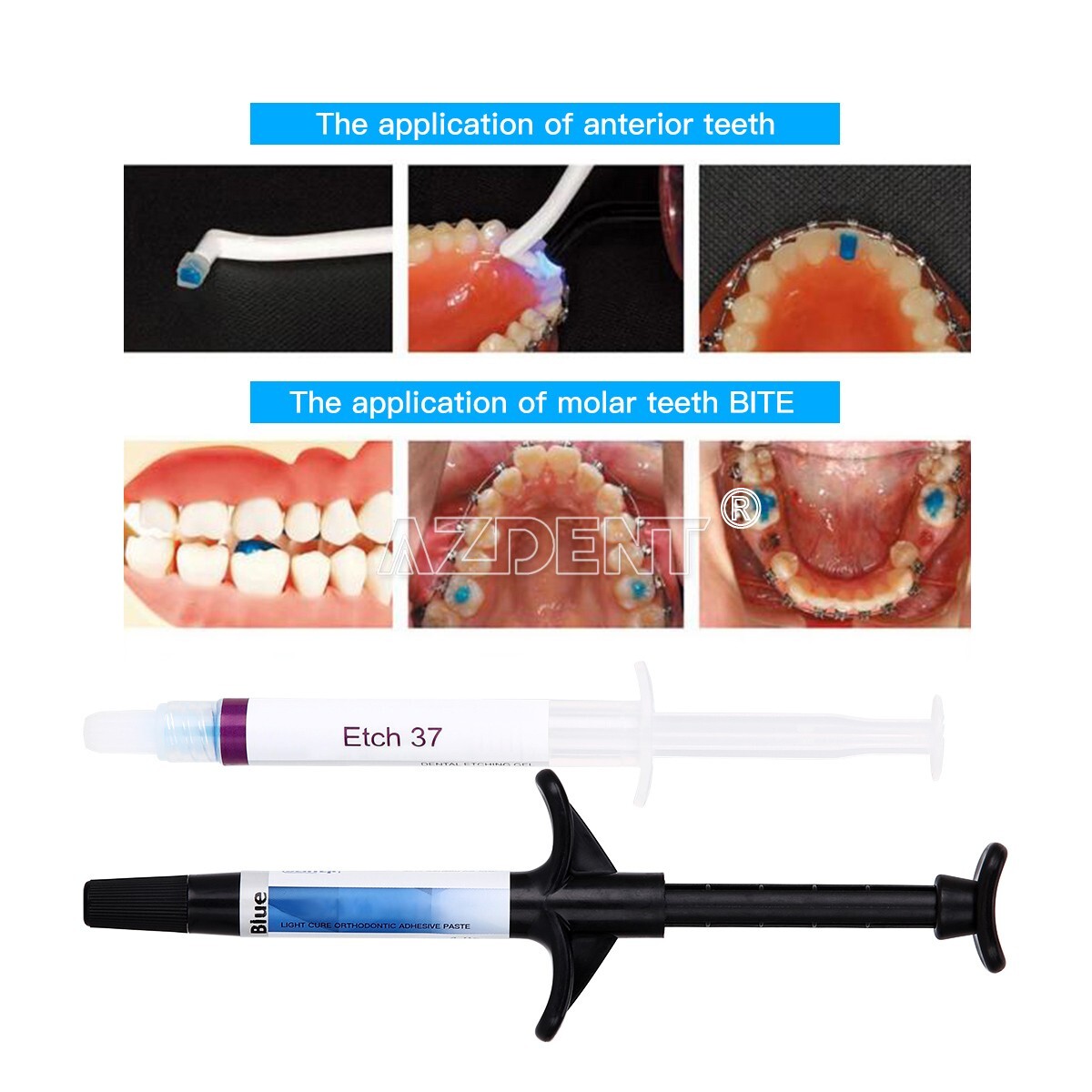 Dentex Dental Orthodontic Adhesive Light Cure Band Bonding Cement Blue Glue Kit