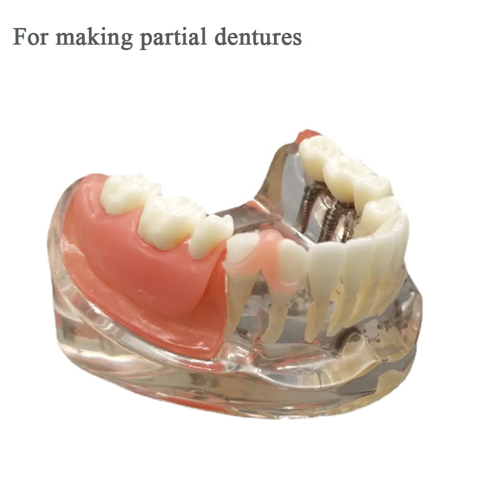 Gum Material for DIY Denture Improve Smile, Tooth Repair Kit, Teeth gum color
