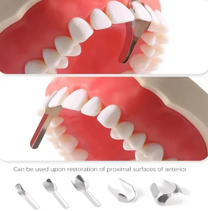 Dental Anterior Matrix Bands Sectional Contoured Twin Matrices Proximal Strips
